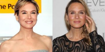 Renee Zellweger Face